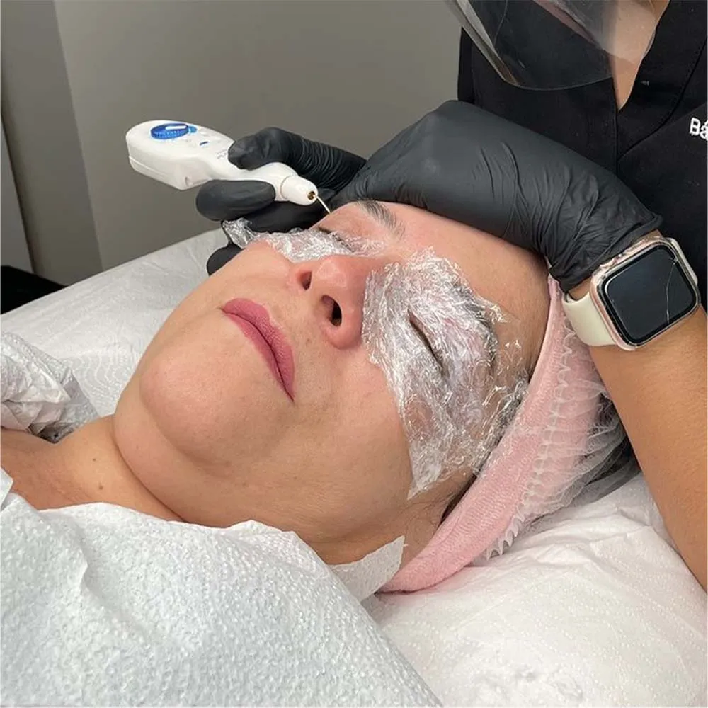 Does Plasma Pen Leave Scars? What Experts Say