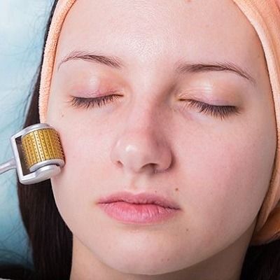 Plasma Pen Treatment Delivers Youthful Results