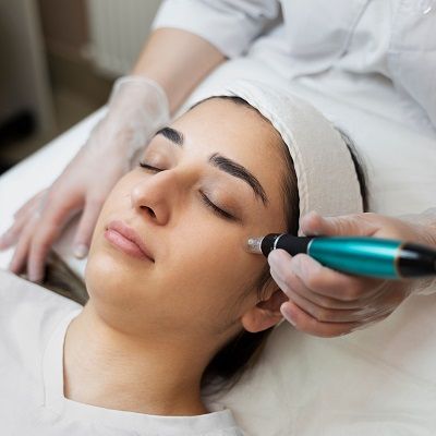 Plasma Pen Skin Tightening Explained