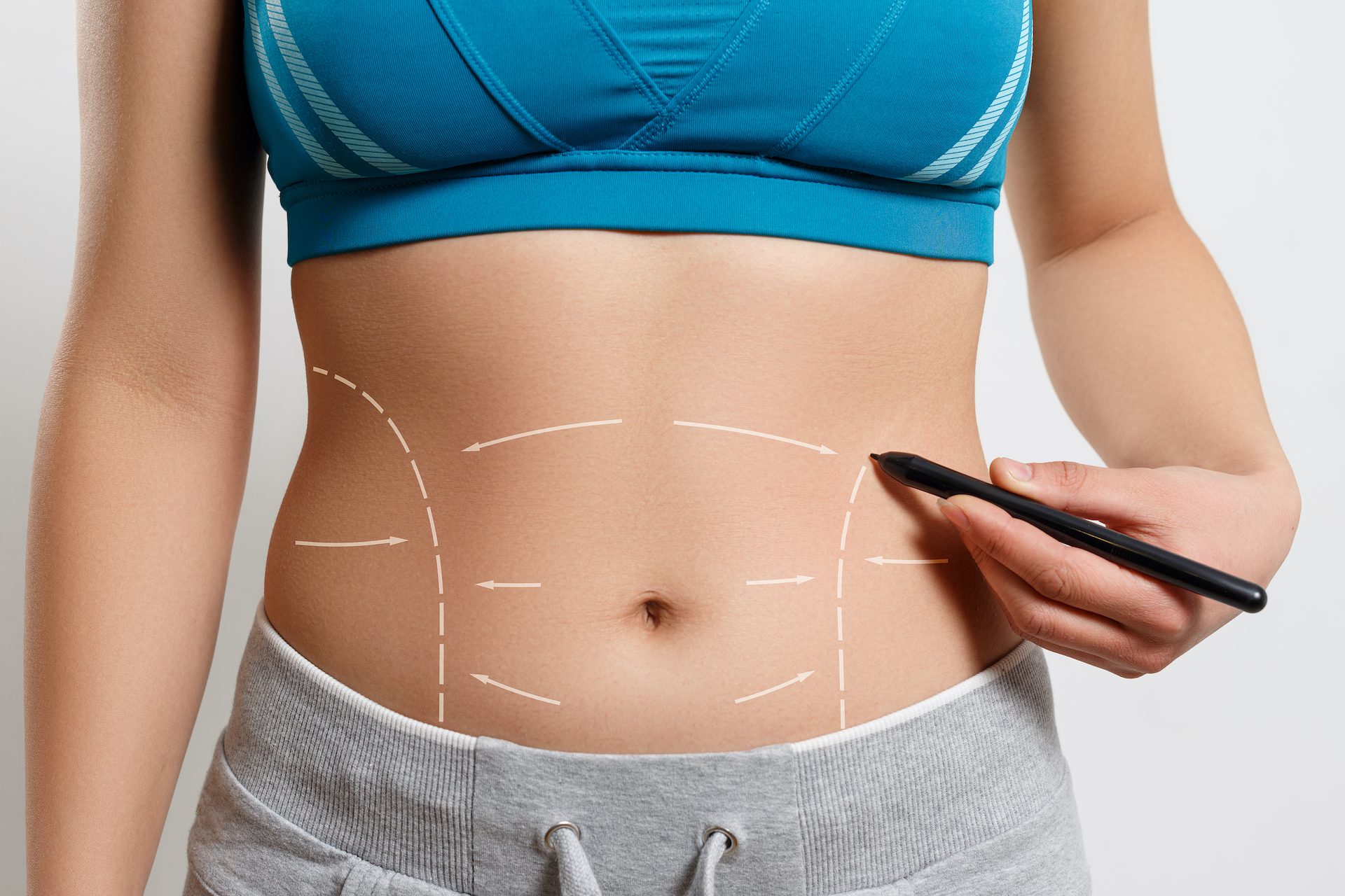 Liposuction Cost Estimates for Dubai Residents