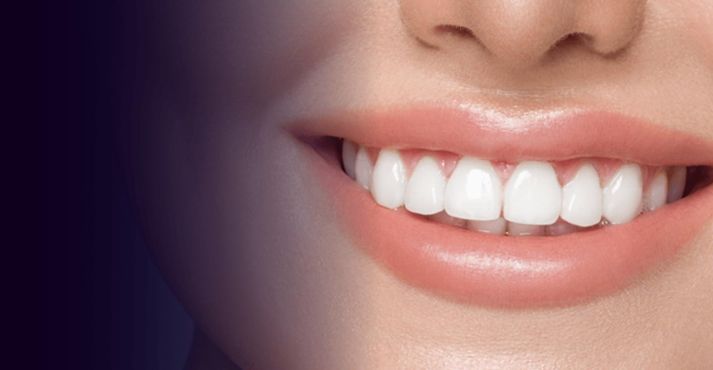 Expert Tips to Save on Teeth Whitening Cost Services