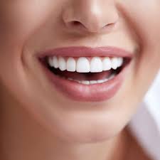 Are Composite Veneers a Permanent Solution for Stains?