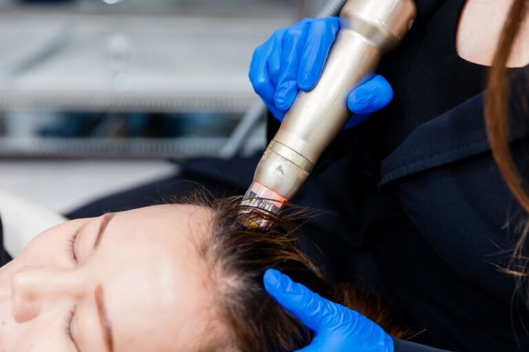 How to Maximize Results From Hair Loss Treatment Safely